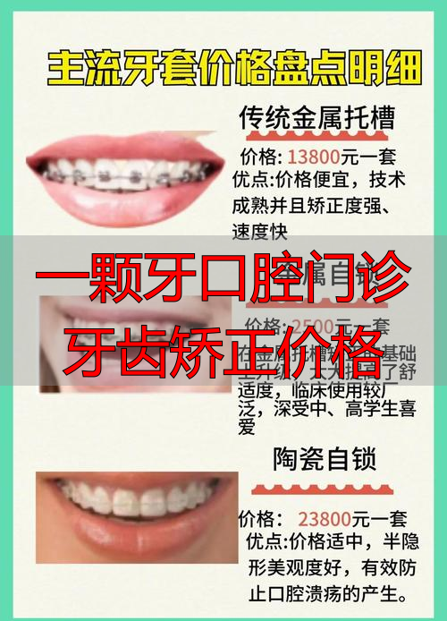 口腔医院矫正牙科_一颗牙口腔门诊牙齿矫正价格_口腔门诊牙齿矫正牙价格表