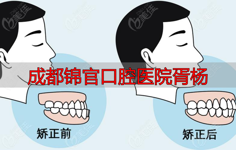 成都锦官口腔医院胥杨医生怎么样？背景、技术与矫正特点详解
