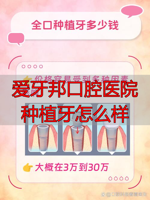 爱牙邦口腔种植牙真实体验：聊聊技术、医生和价格那些事儿