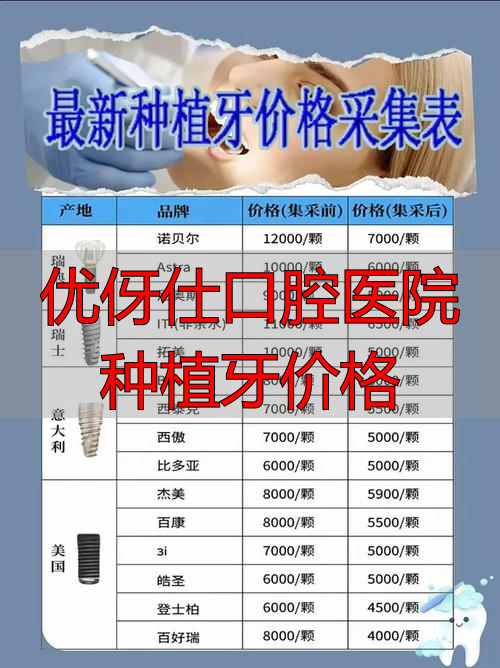 口腔医院种牙多少钱一克_优伢仕口腔医院种植牙价格_口腔医院种植牙齿价格