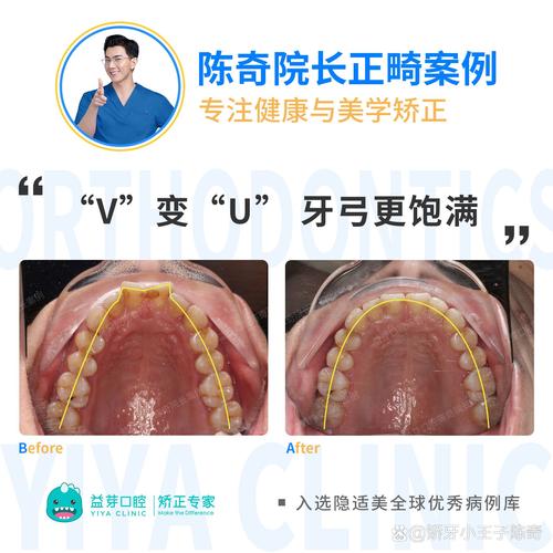 安阳博恩口腔门诊怎么样？牙齿矫正优势及效果反馈大揭秘