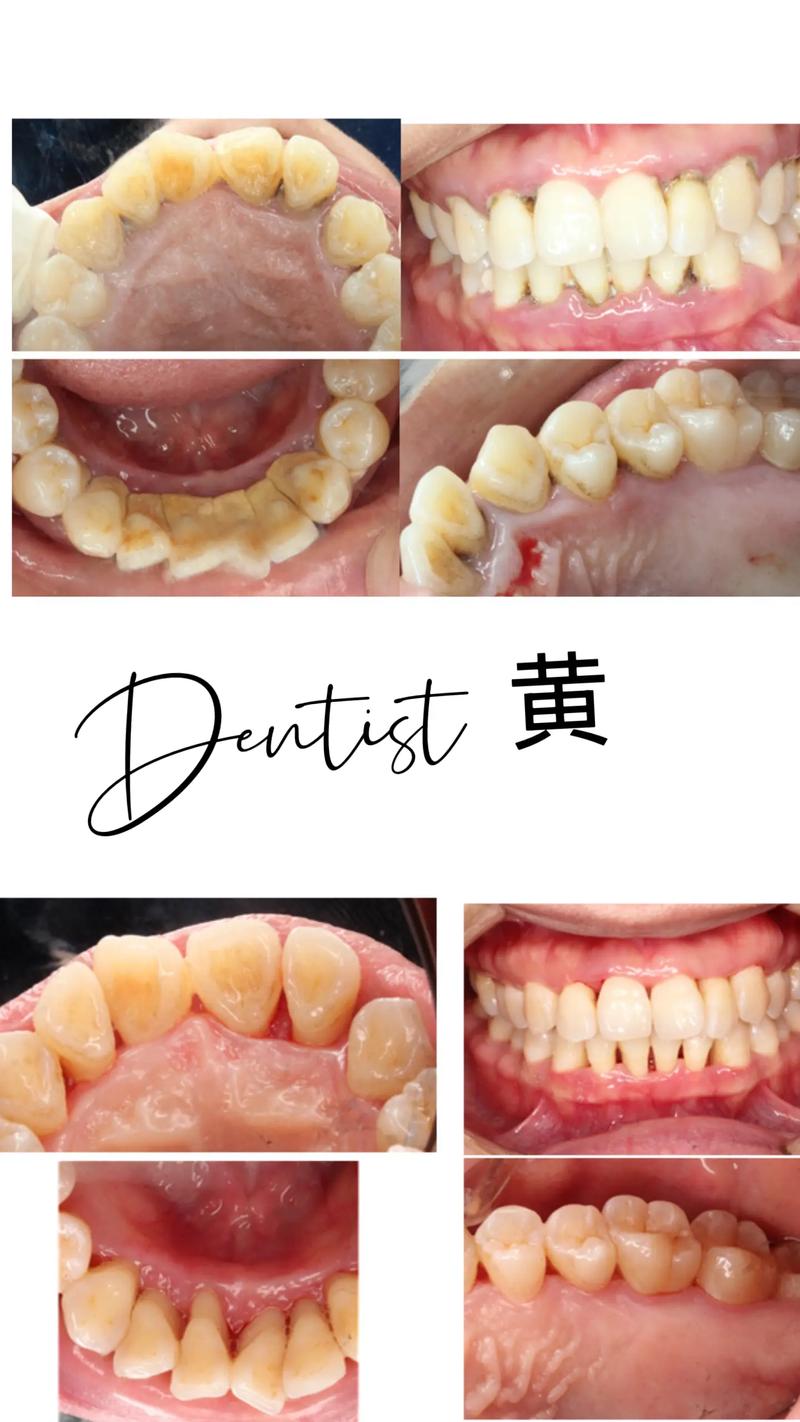 亳州口腔科_毫州口腔医院排名_亳州哪个医院口腔科好