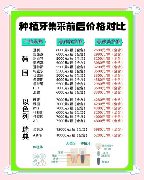 历下诺雅口腔诊所种植牙价格_口腔诊所种植牙齿安全吗_口腔诊所种植牙规章制度