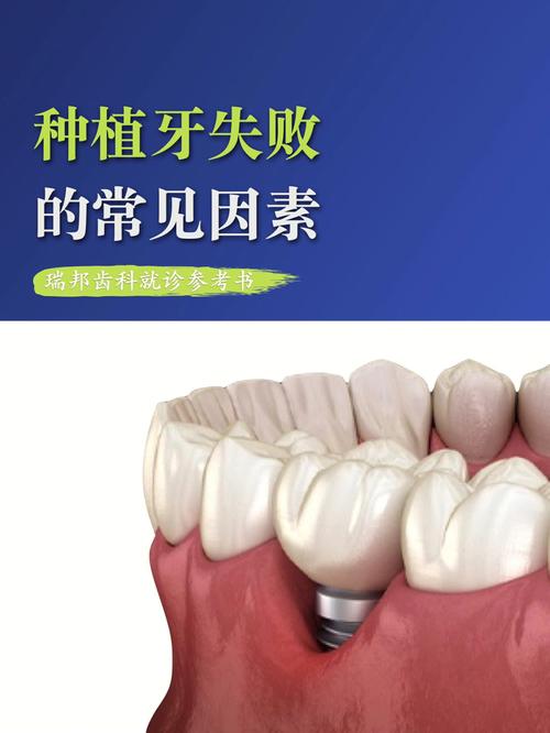 广州德隆口腔门诊辛少群_广州德隆牙科诊所_广州德隆齿科很贵