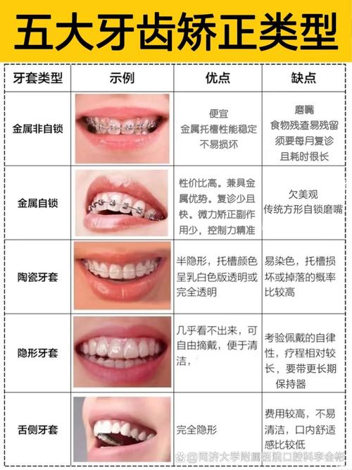 汕尾口腔医院排名_口腔排名汕尾医院有几家_汕尾口腔医院是公立的吗
