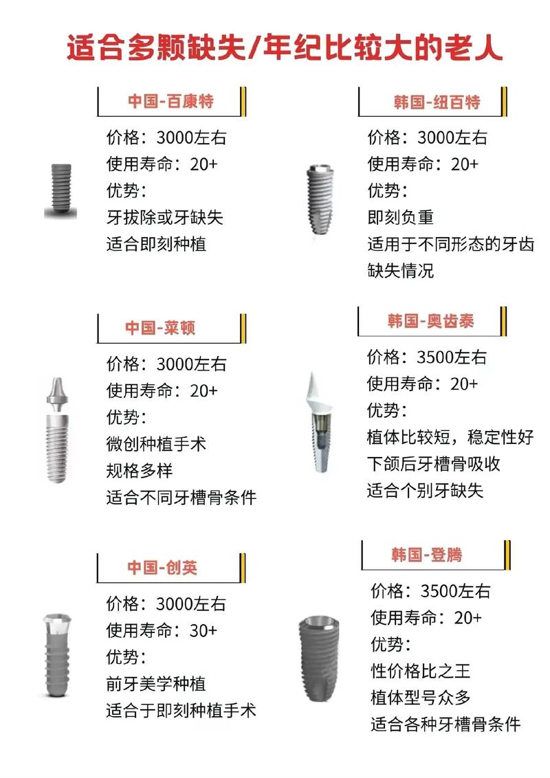青岛牙齿种植_青岛口腔医院种牙收费标准_青岛艾诺口腔门诊部种植牙怎么样