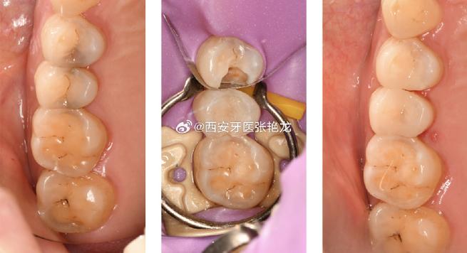 2026年1月哈尔滨牙医口碑排行榜：雅博口腔张艳医生怎么样？真实评价推荐