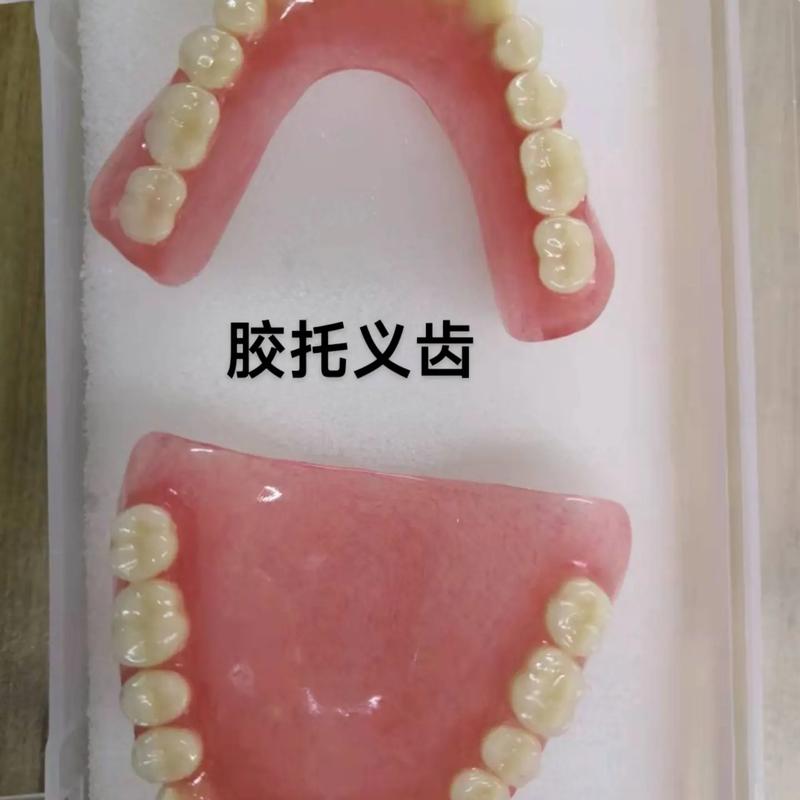 菏泽牙齿整形_菏泽镶牙哪里好_菏泽欧诺口腔门诊部假牙价格