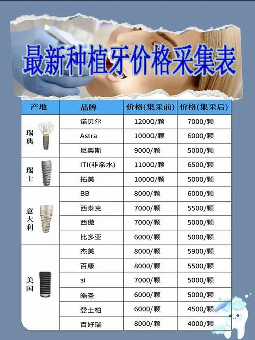 口腔医院种植牙费用_潜江众大口腔门诊部种植牙价格_口腔种植专科门诊