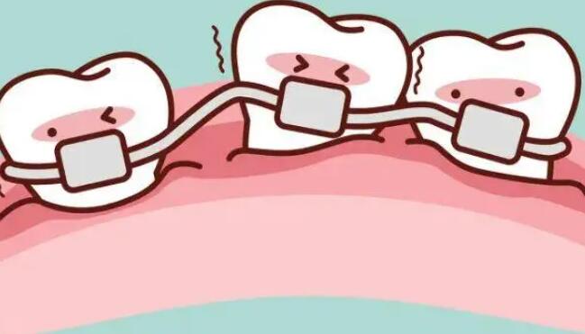 瑞格口腔诊所（河北大街店）假牙价格_爱洁口腔诊所 石家庄爱洁口腔地址 爱洁口腔真实案例