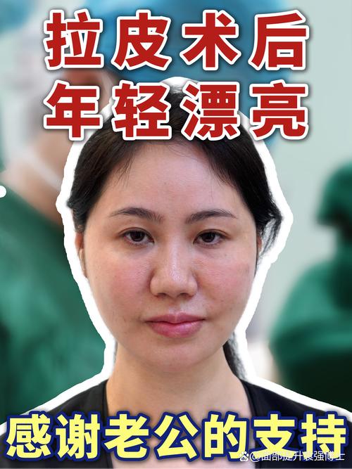 新桥医院颌面外科主任_西宁新桥口腔医院邹燕婕_青海省新桥口腔医院