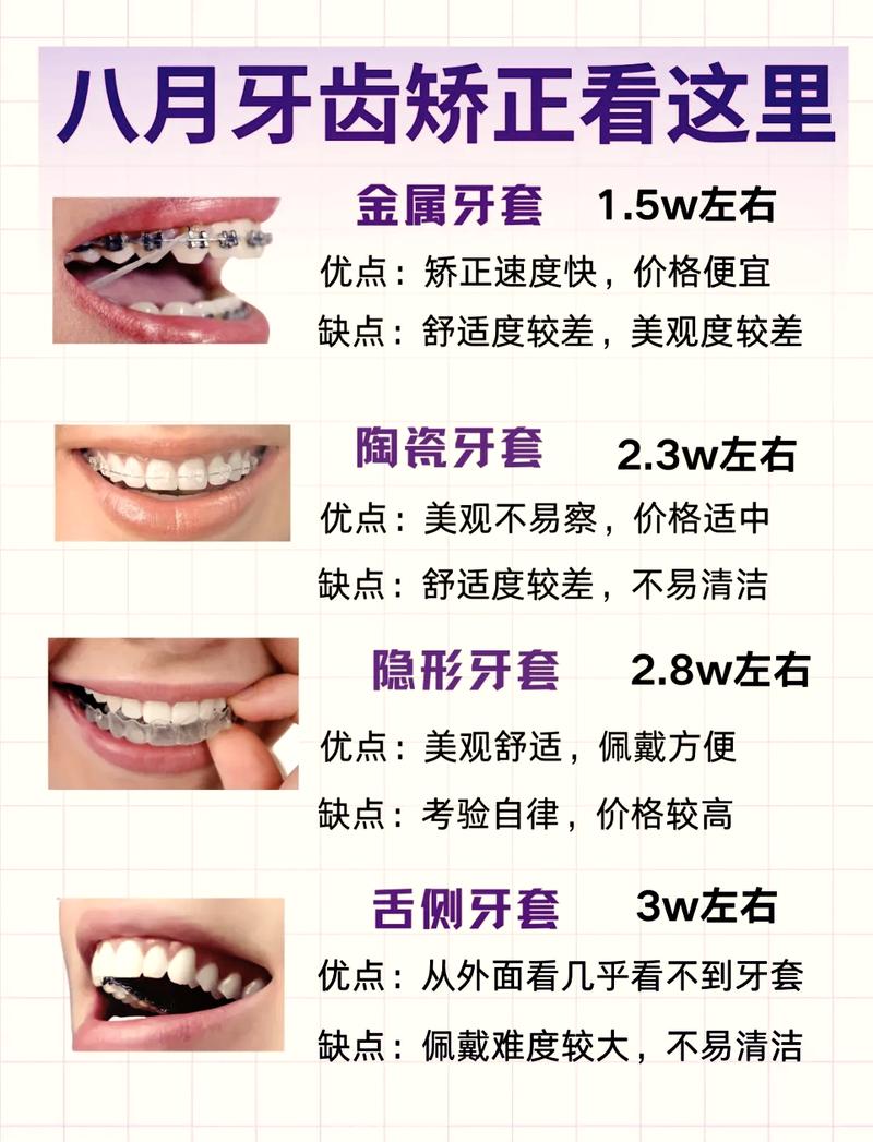 成人暴牙矫正方法_溧水固德口腔门诊部牙齿矫正价格_太仓六贝口腔门诊部